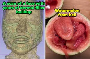 On the left, a scan showing a face with years of dermal filler buildup. On the right, a split watermelon with unusual, distorted interior, labeled "Watermelon from hell."