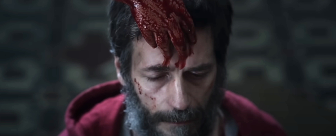 Actor in a scene with a bloodied hand on their forehead, eyes closed, expressing pain or distress