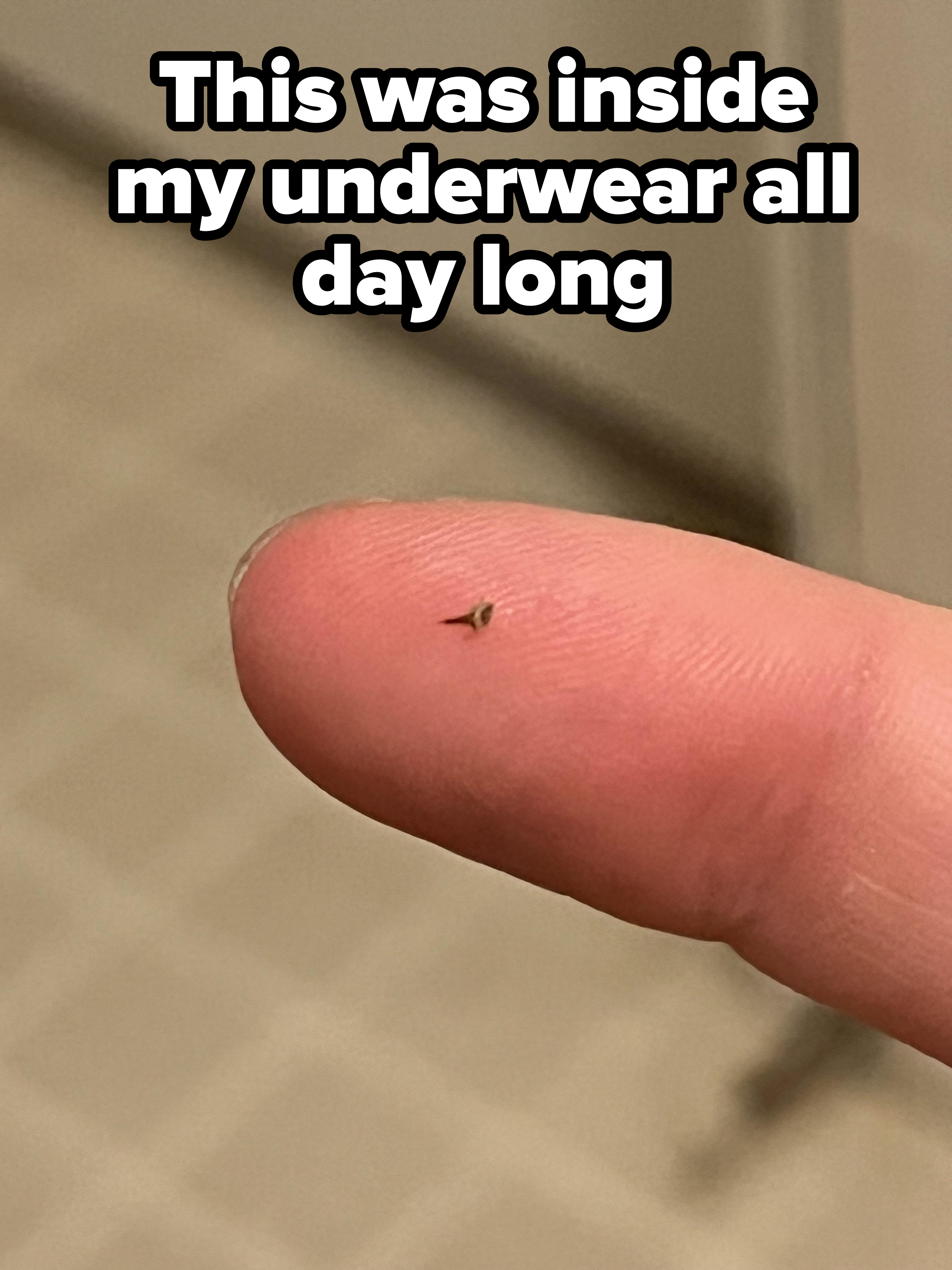 A close-up of a person&#x27;s fingertip with a tiny splinter embedded near the center