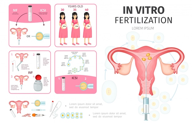 Płaska infografika zapłodnienia in vitro z preparatem nasienia kobiety w ciąży zapłodnione narzędzia medyczne do sztucznego zapłodnienia rozwoju jaja