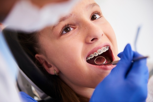 Foto grátis rapariga com aparelho ortodôntico durante um exame dentário de rotina