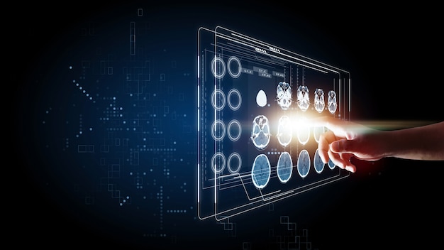 Cérebro tomografia computadorizada e imagem do raio X mão tocando conceito gráfico de informação de tecnologia futurista