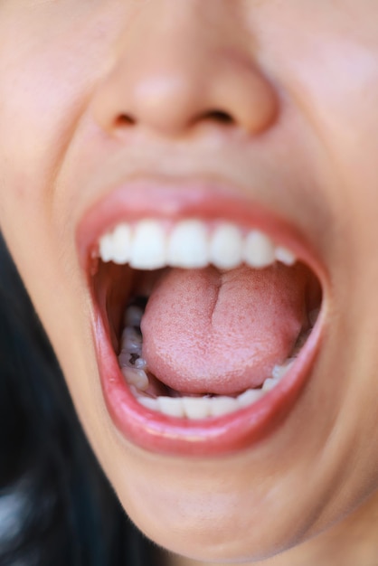 Foto close-up de cárie dentária jovem mulher da ásia, então devemos ser cuidados dentários com a higiene problemas de saúde bucal e placa e tártaro conceito de odontologia saudável beleza tratamento de cuidados de saúde