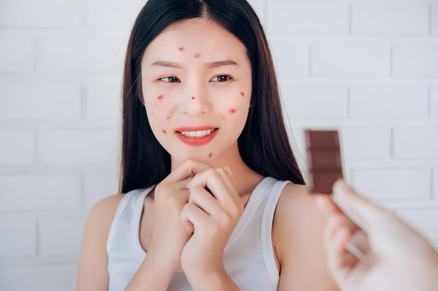 Foto jovem mulher asiática com problema de acne com uma barra de chocolate, mas feliz comendo