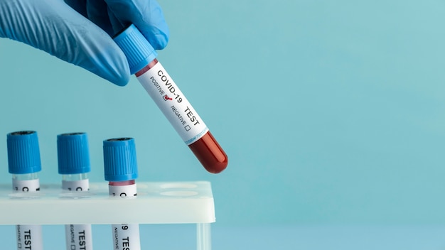 Free photo hand with protective gloves holding a blood samples for covid test