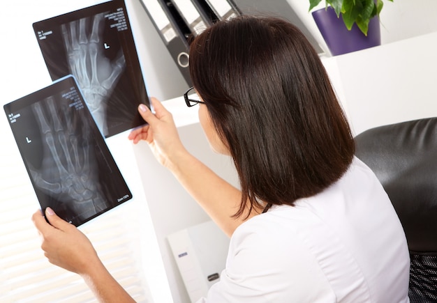 Free photo woman doctor is looking at xray of broken hand