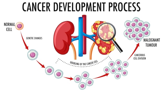 Diagram showing cancer development process