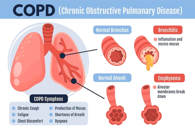 Flat-hand drawn copd infographic template