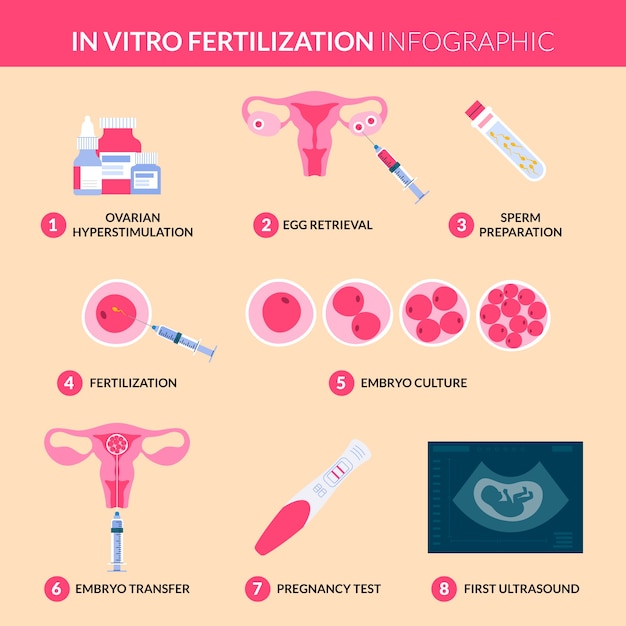 Free Vector hand drawn flat design ivf infographic