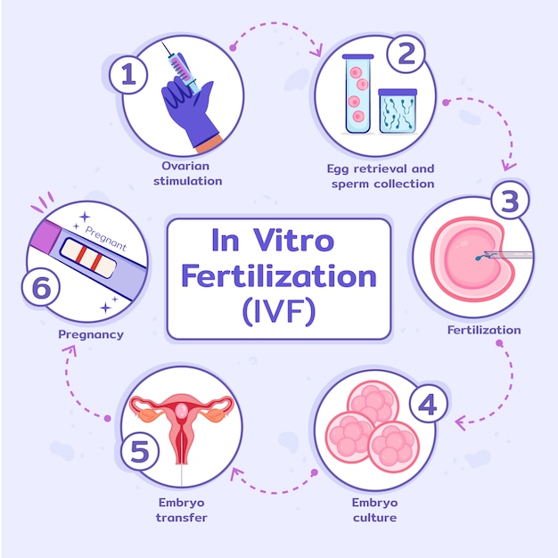 Free Vector hand drawn flat design ivf infographic