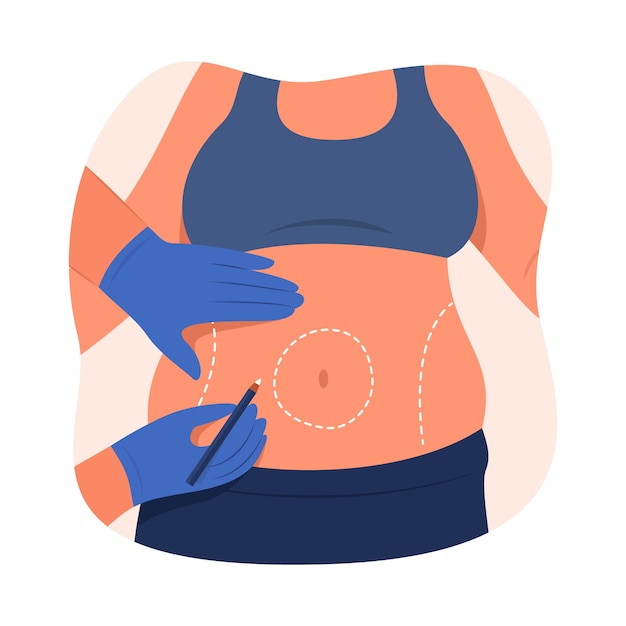 Free Vector hand drawn flat design liposuction illustration