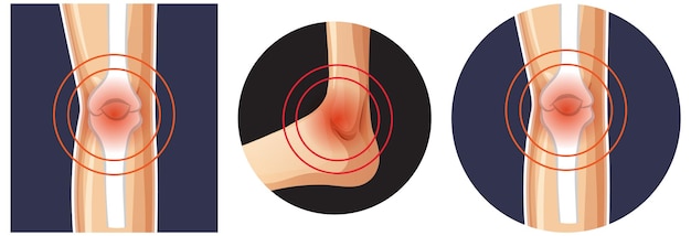 Free Vector human bone joint concept