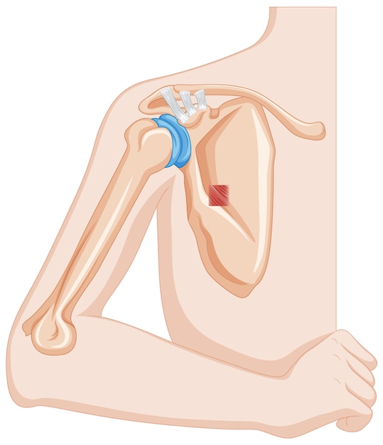 Free Vector human elbow bone anatomy illustration