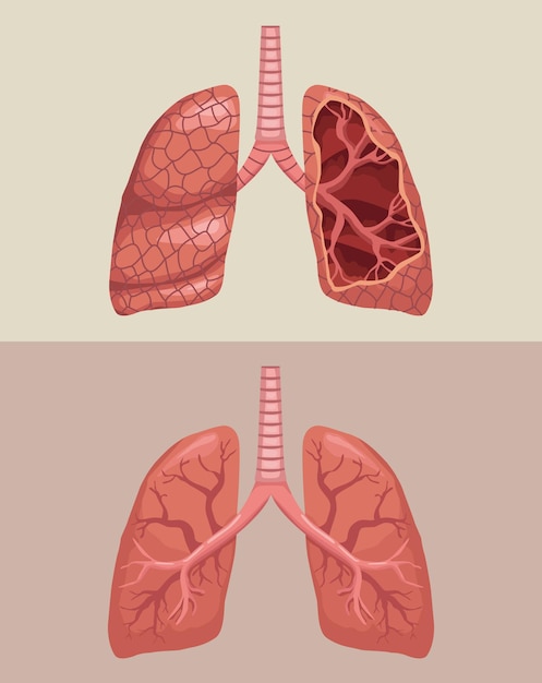 Free Vector realistic lungs human organs poster