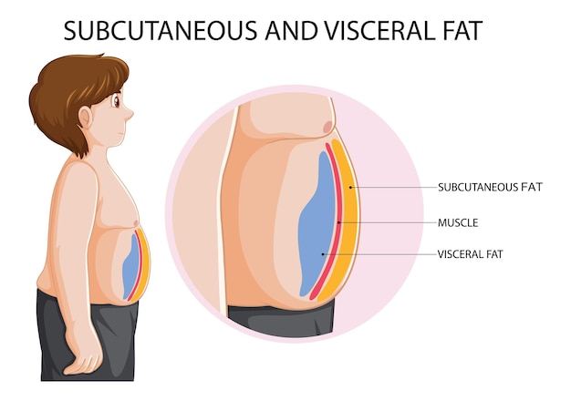 Free Vector subcutaneous and visceral fat diagram