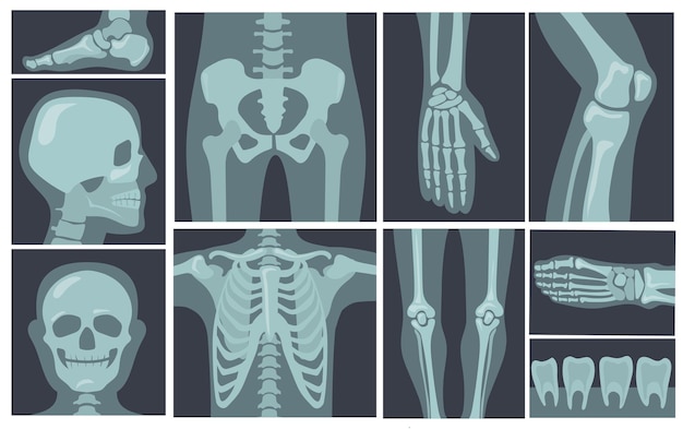 Free Vector x-ray shots of human body