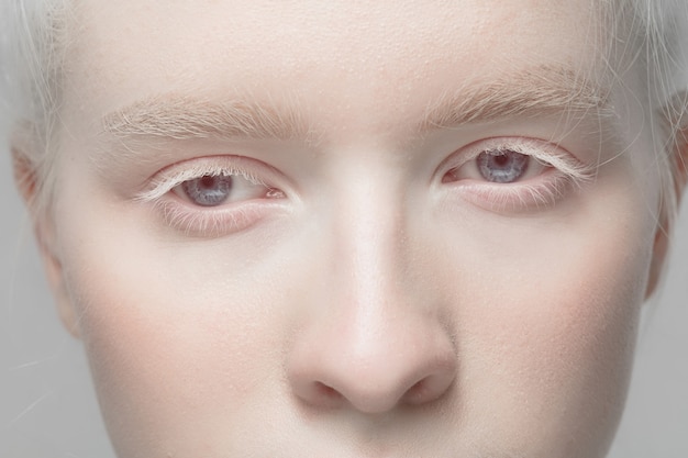 Photo gratuit bouchent le portrait de la belle femme albinos isolée en studio. . des détails.