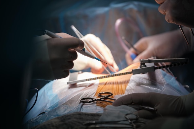 Closeup of professional doctor hands operating a patient during open heart surgery in surgical room Healthcare and medical intervention concept