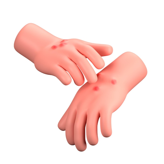 PSD hand gesture alergic skin medical