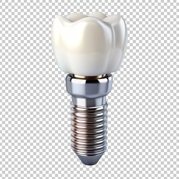 Tooth implant cutout