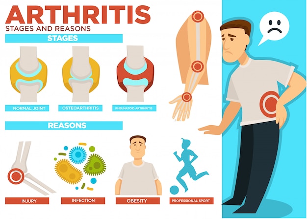 Vector arthritis stages and reasons of disease poster