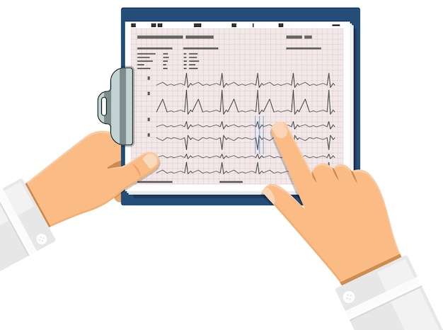 Cardiogram on clipboard in hands of doctor