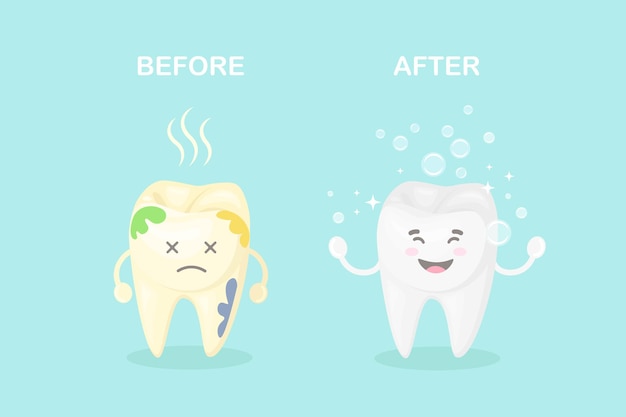 Cleaning and whitening teeth