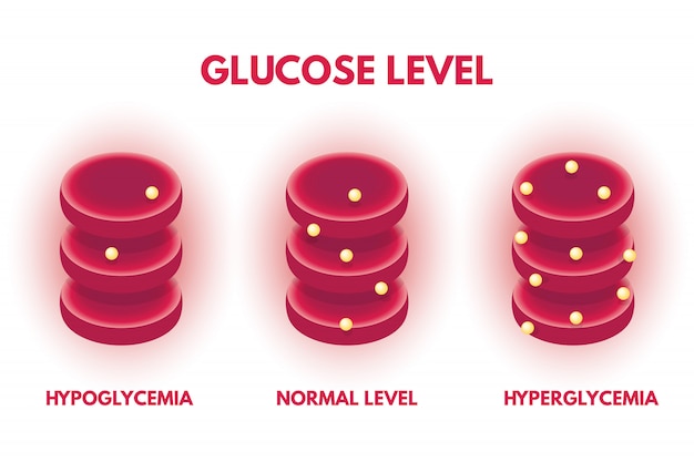 Vector hyperglycemia, hypjglycemia human glucose levels isometric. vector illustration.