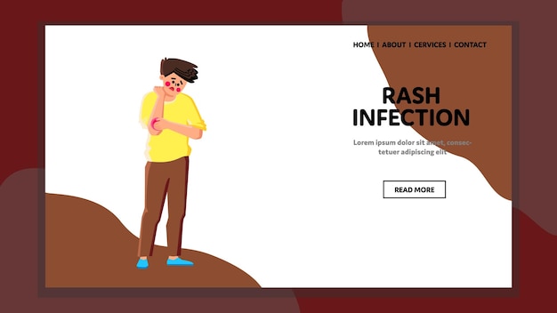 Rash infection vector