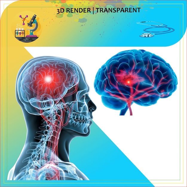 Anatomia do cérebro pulmões humanos neurologia pulmões infecção corpo dor cabeça dor neurocirurgia doença