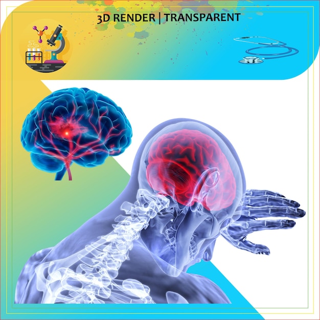 PSD anatomia do cérebro pulmões humanos neurologia pulmões infecção corpo dor cabeça dor neurocirurgia doença