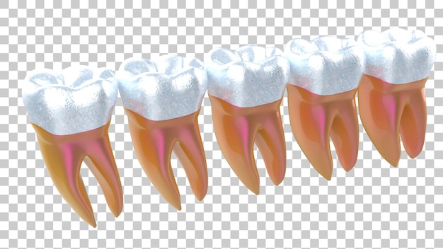 PSD illustration d'implant de dent isolée sur un fond transparent en 3d