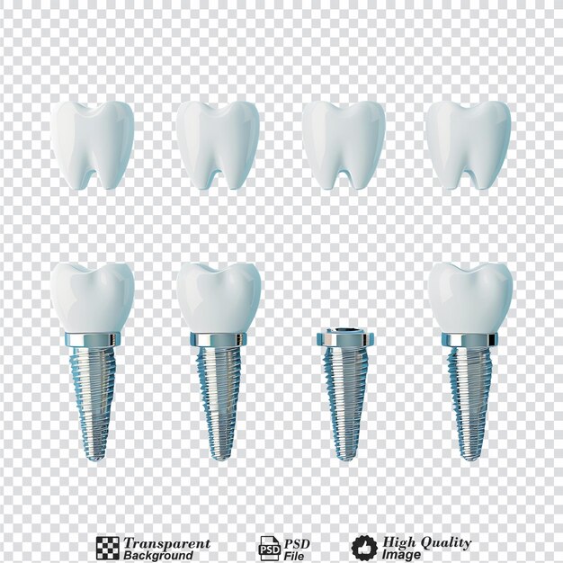 PSD maquette d'implant dentaire dans différentes positions isolée sur un fond transparent