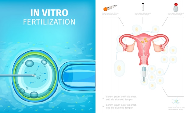 Composition du processus de fécondation in vitro à plat avec système reproducteur féminin développement des œufs fécondés outils médicaux pour l'insémination artificielle