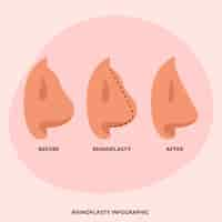 Vecteur gratuit infographie de rhinoplastie design plat dessiné à la main