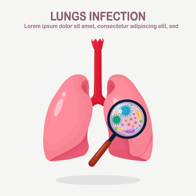 Lungen mit Atemwegsinfektion und Lupe. Bakterien, Mikroben, Viren, Keime in Organen