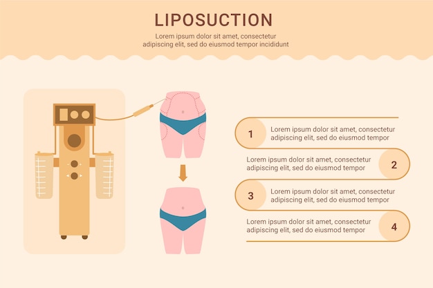 Vetor grátis infográfico de lipoaspiração de design plano desenhado à mão