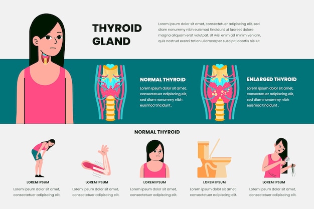 Vetor grátis infográfico de tireóide de design plano desenhado à mão