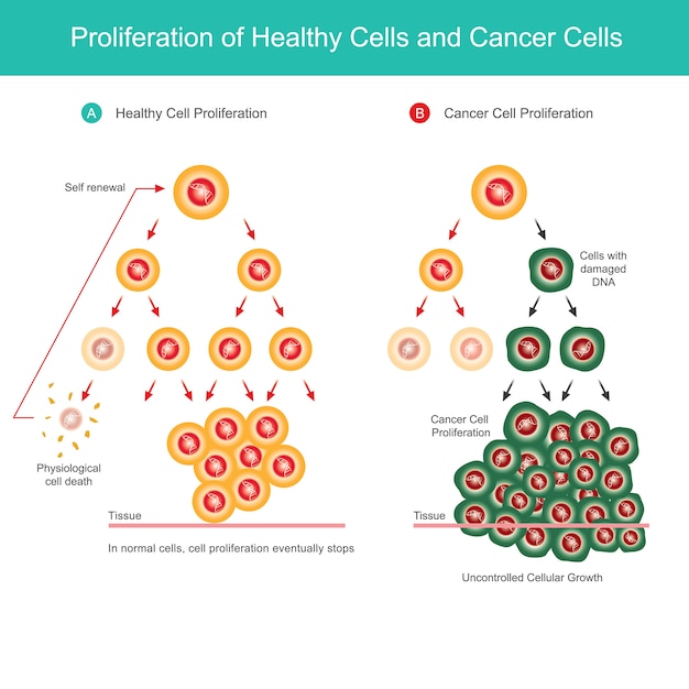 Vetor proliferação de células saudáveis e células cancerígenas. ilustração de comparação da proliferação celular normal e proliferação de células cancerígenas no corpo.