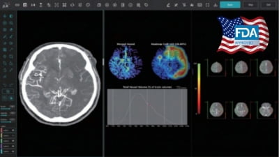 제이엘케이 '주력 제품' 뇌졸중 AI 솔루션, FDA 첫 허가