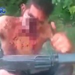 【閲覧注意】銃で顔を吹き飛ばされた男、親指を立てるほど余裕。