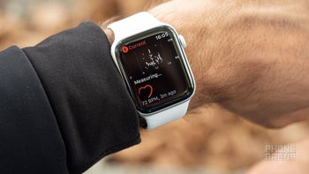 Apple Watch detected what a resting ECG couldn't, saved the life of a doctor