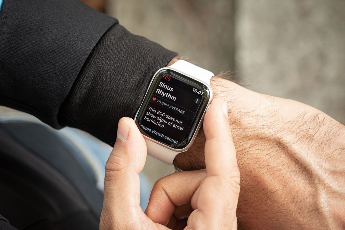 The Apple Watch heart sensor and ECG feature may do more harm than good for many users