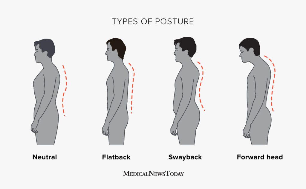 An illustration of four types of posture: neutral, flatback, swayback, and forward head posture.