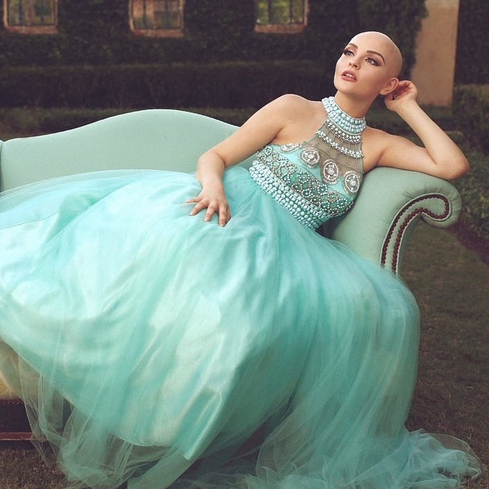 This Teen's Modeling Shoot After Chemotherapy Will Make You Feel So Many Feelings