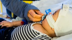 Ausreichender Schutz vor RSV für Babys weiter fraglich