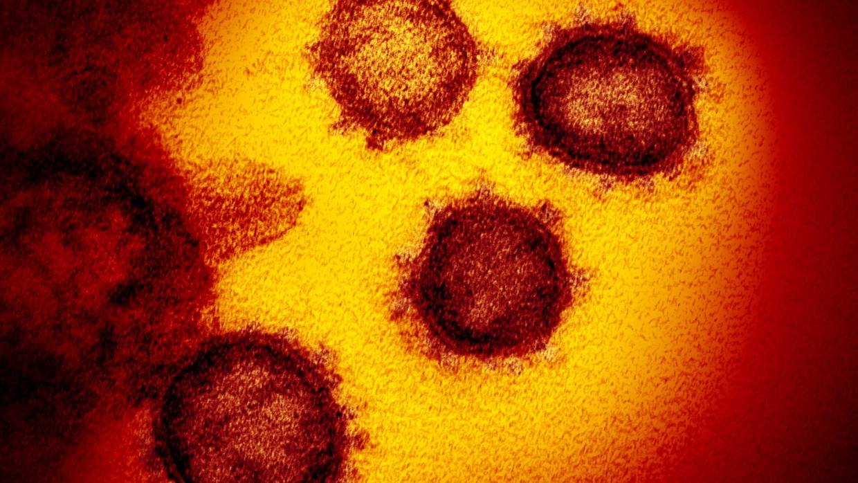 Die vom National Institute of Allergy and Infectious Diseases zur Verfügung gestellte Elektronenmikroskopaufnahme zeigt das Coronavirus SARS-CoV-2.