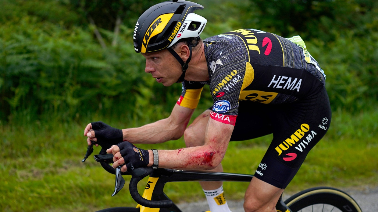 Gezeichnet: Tony Martin verletzte sich bereits am ersten Renntag der Tour de France.