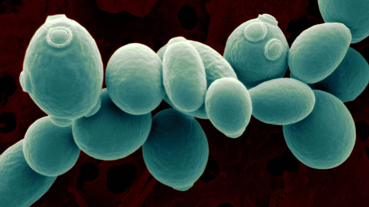 Zellen des Hefepilzes Saccharomyces Cerevisiae.