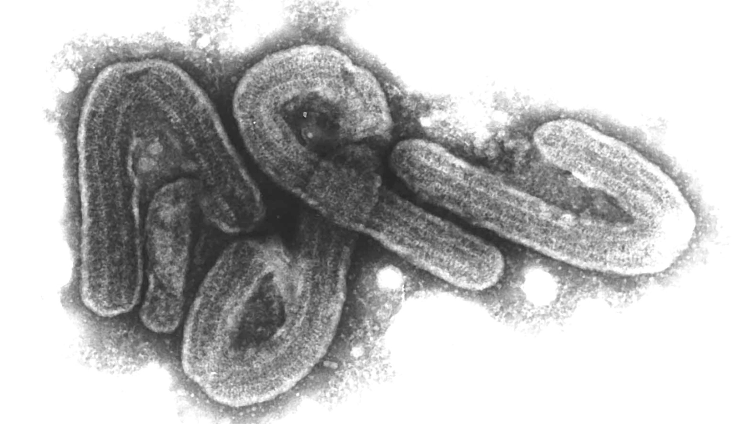 Das Marburgvirus in einer elektronenmikroskopischen Aufnahme